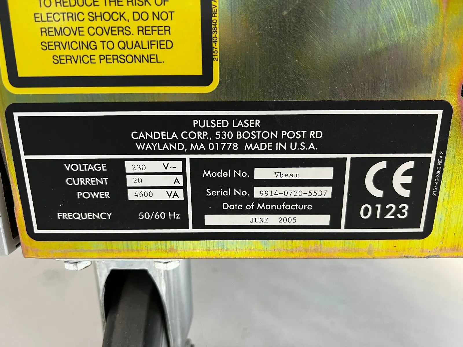 2005 Candela V-Beam PDL Pulsed Dye Laser Pulse VBeam Lesions Vascular AS IS