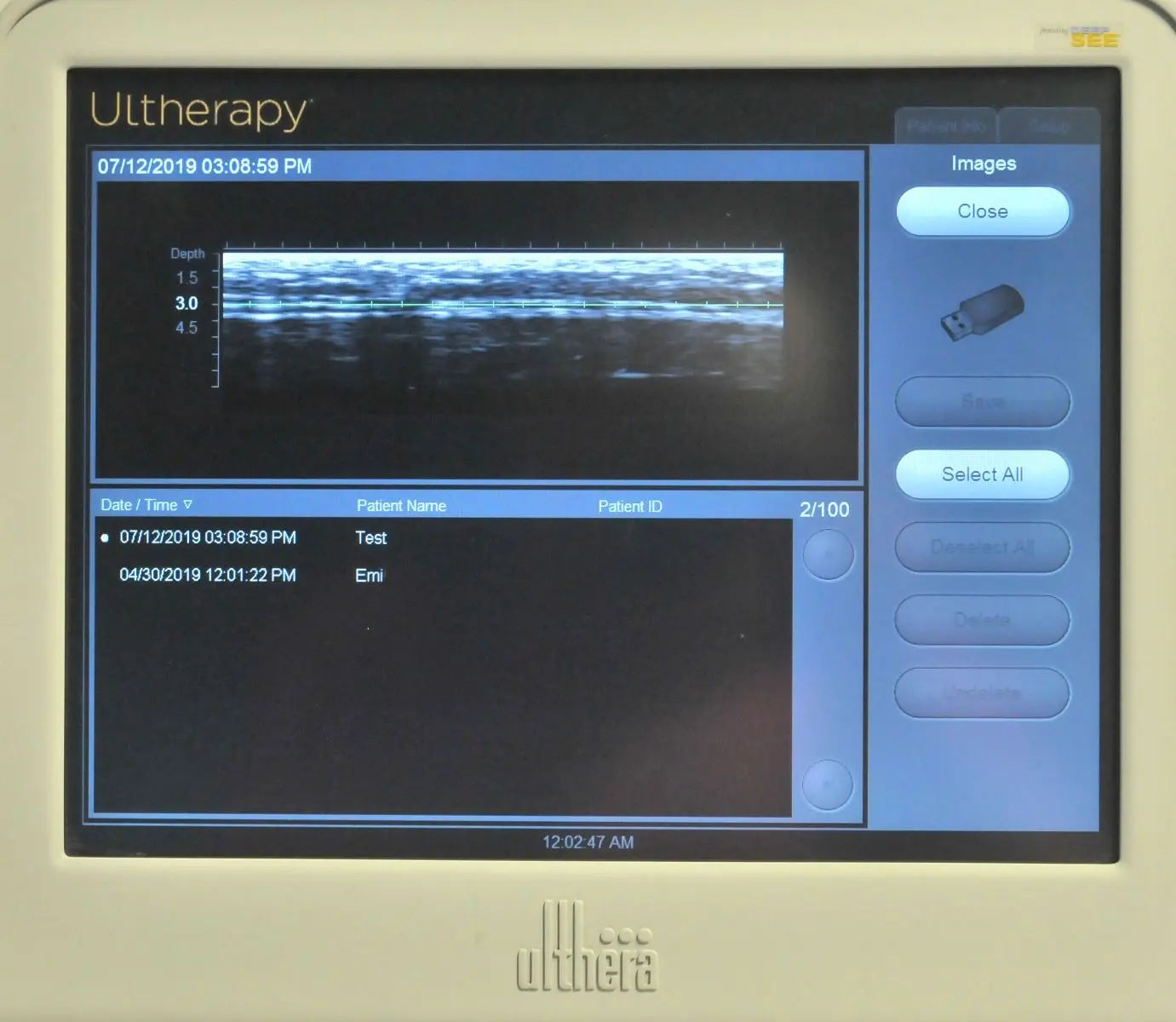2013 Ulthera Ultherapy DEEPsee Ultrasound Skin Tightening Contouring + Handpiece