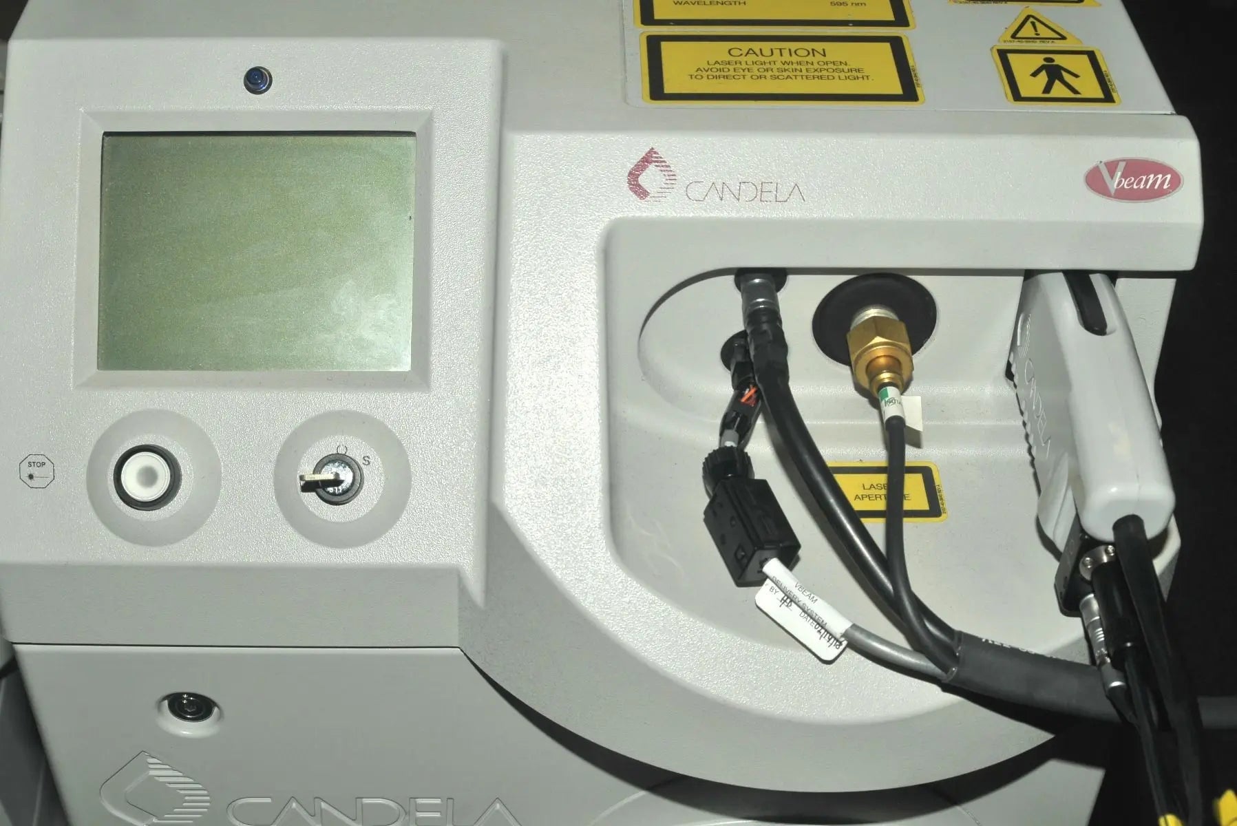 2005 Candela VBeam Wrinkles Scars Acne Stretch Marks Pulsed Dye Laser System