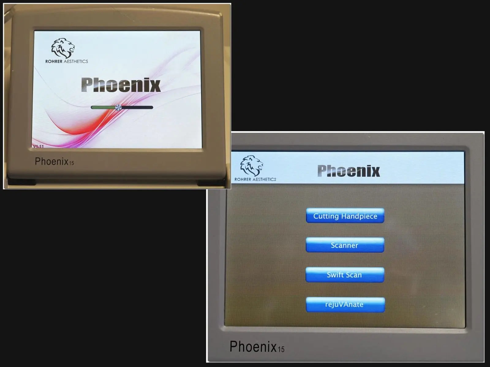 2018 Rohrer Aesthetics Phoenix-15 Skin Pigmentation Vaginal Rejuvenation CO2 Laser