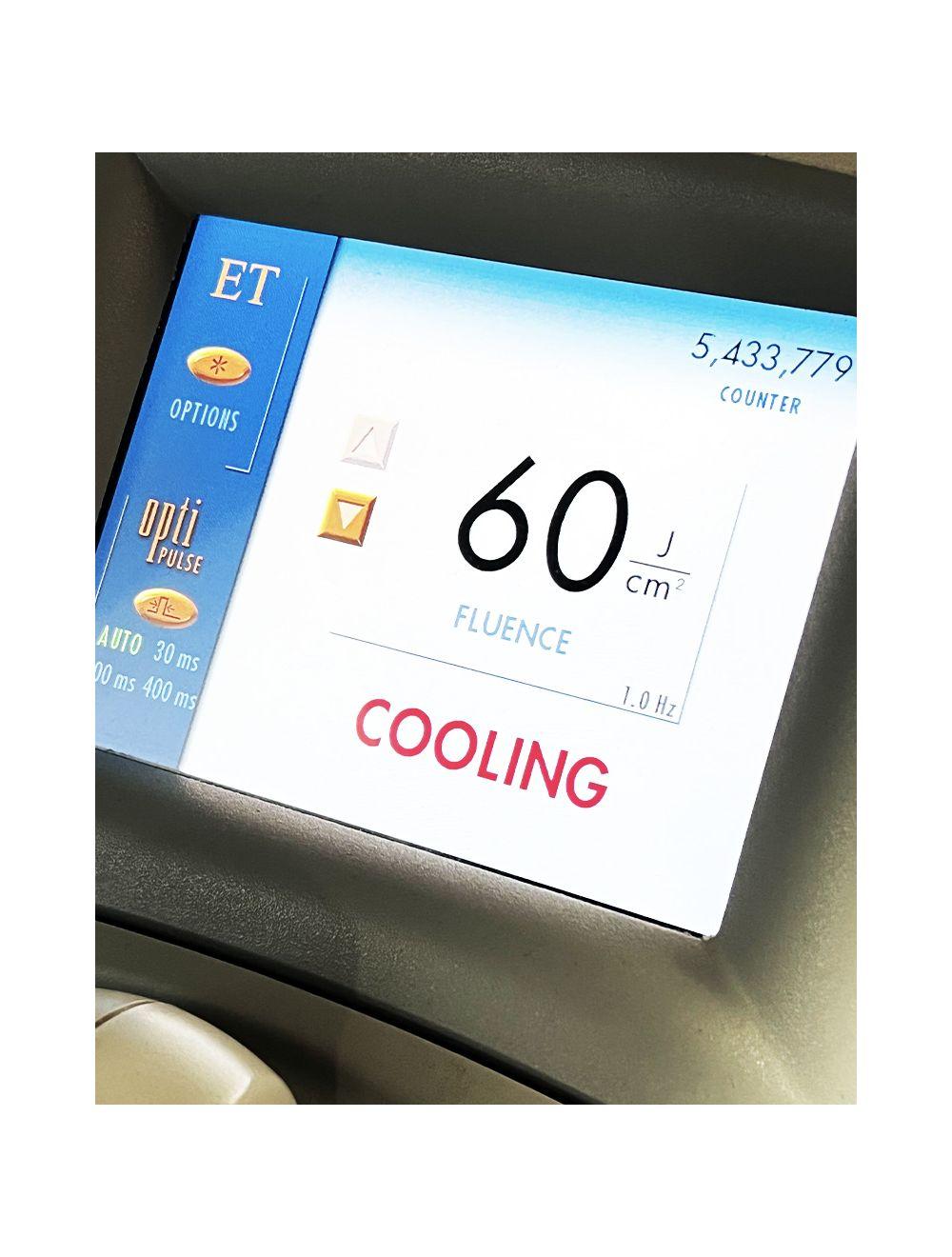 Lumenis LightSheer ET Diode Pigmented Lesion Laser Hair Removal System Unit