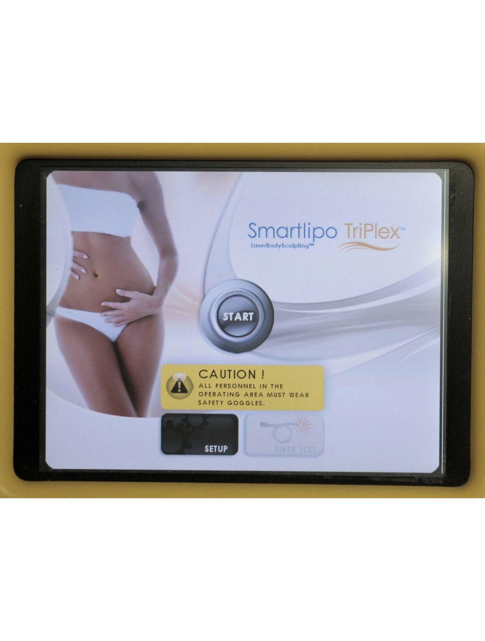 2011 SmartLipo SLT II Cynosure Triplex Cellulaze Palomar Laser Neck Body Nd:YAG