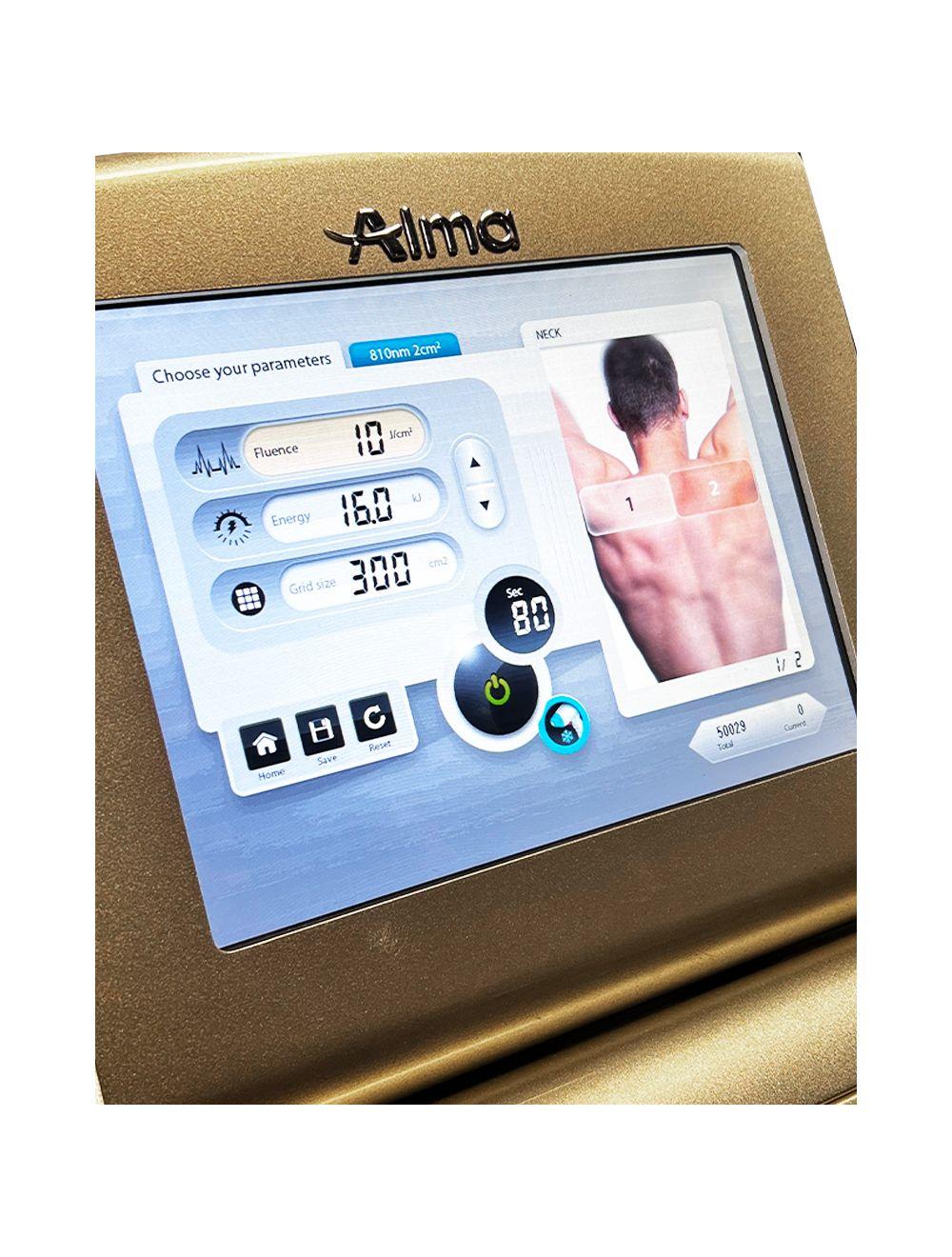 2019 Alma Soprano ICE Alex 755nm Speed 810nm Diode Laser Hair Removal System