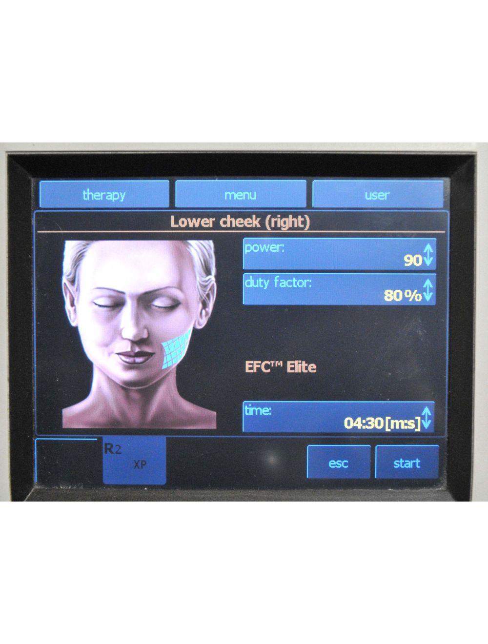 2011 BTL Exilis Elite RF Radio Frequency 90 WATT Laser Contour Skin Tightening