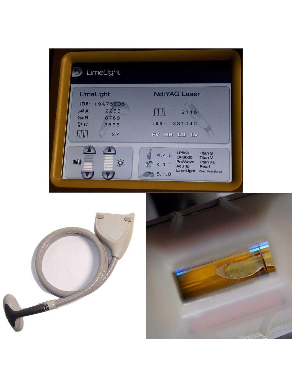 2017 Cutera Xeo Skin Resurfacing Nd:YAG Laser LimeLight Prowave LX Hair Removal