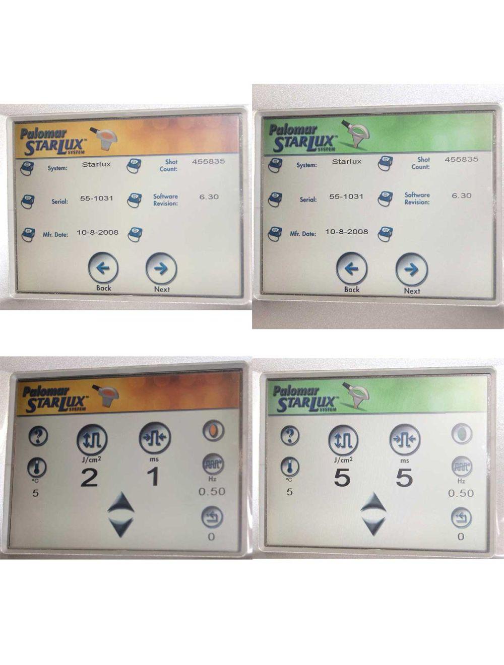 2008 Palomar StarLux 500 IPL Hair Removal Pigmented Lesions Laser MaxG LuxY