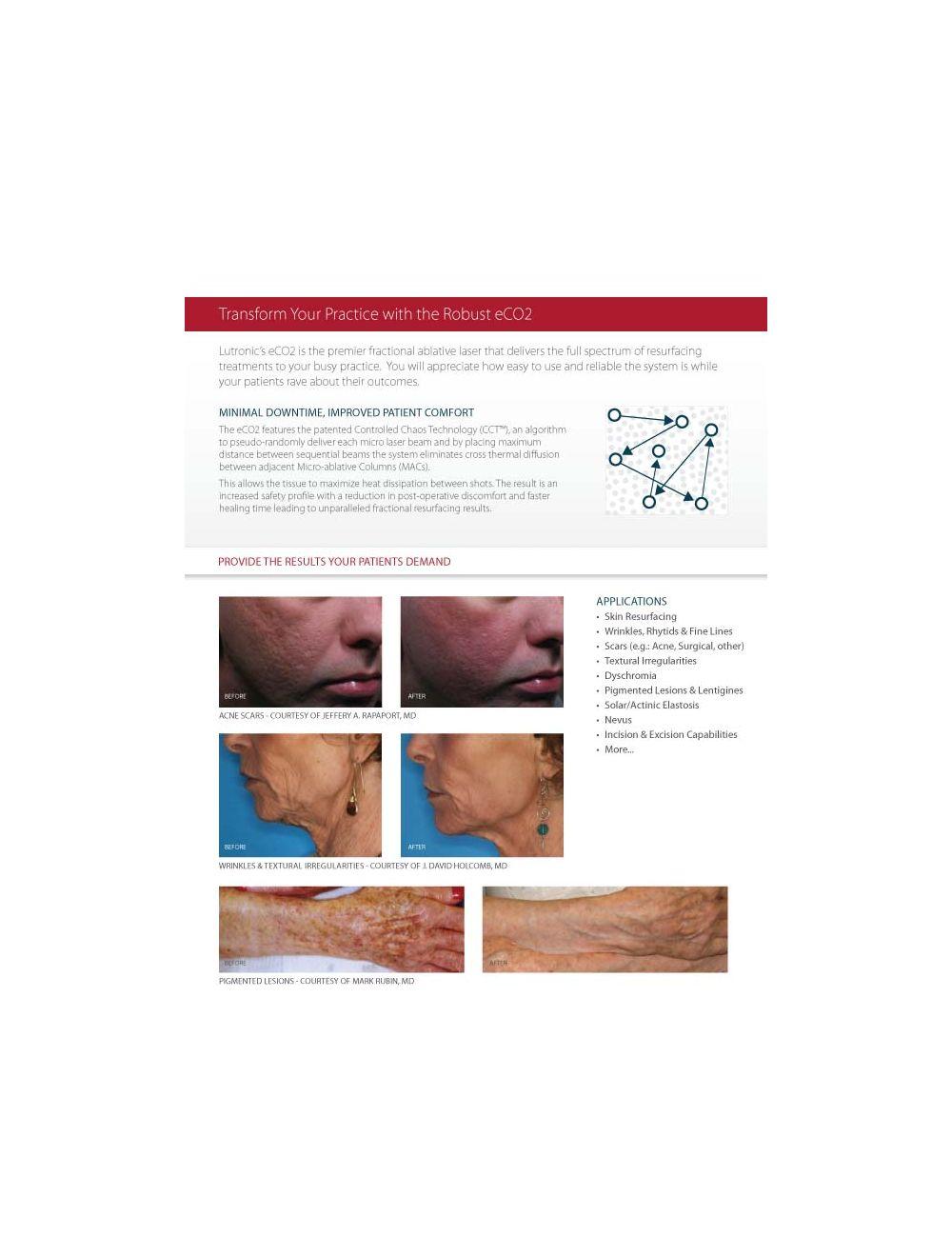 2008 Lutronic Surgical CO2 Laser eC02 Mosaic Skin Fractional Wrinkle Scar Lesion image 6