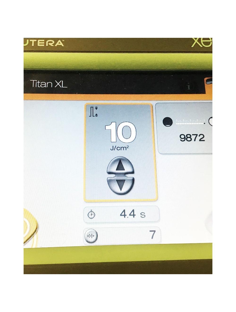 Cutera Titan XL IPL Laser Skin Tightening Rejuvenation Handpiece 7000262T image 6