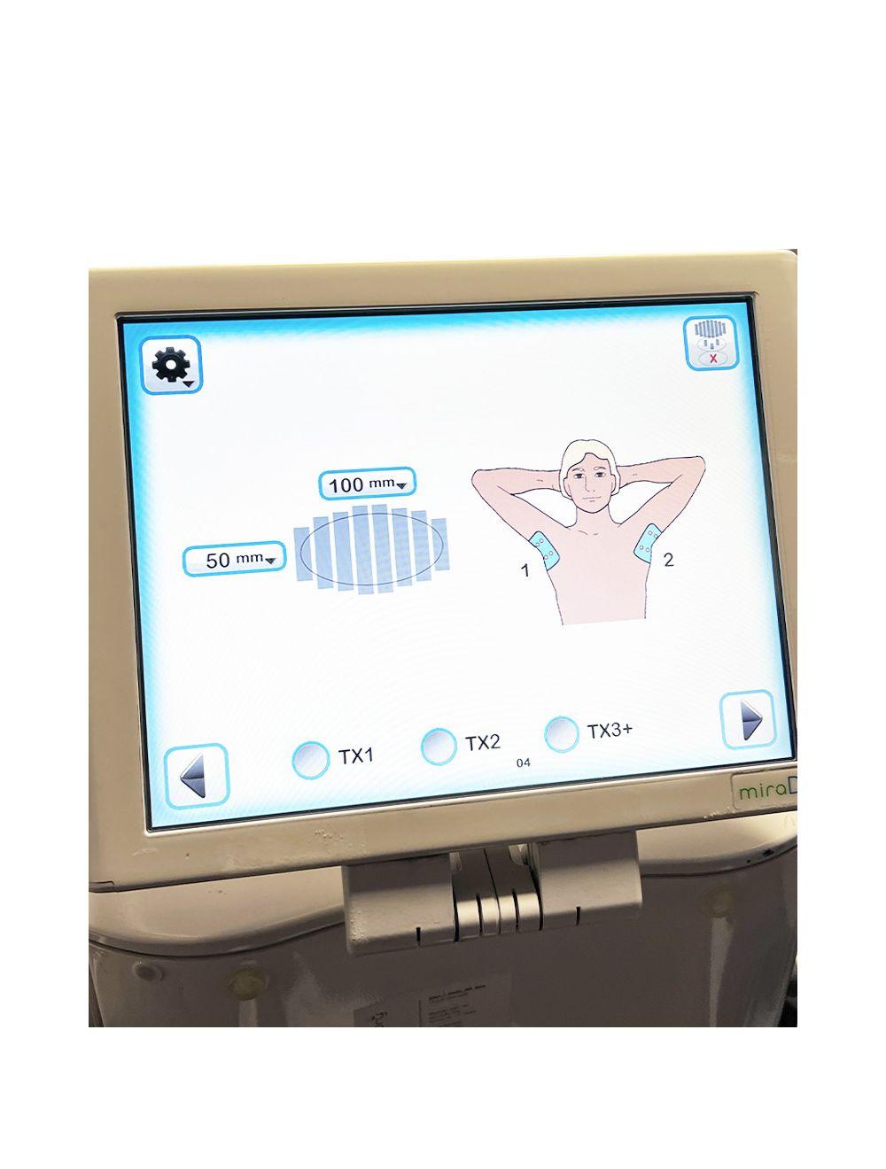 2012 Miramarlabs MiraDry MD4000-MC Sweat Odor Reduction Hyperhidrosis System image 7