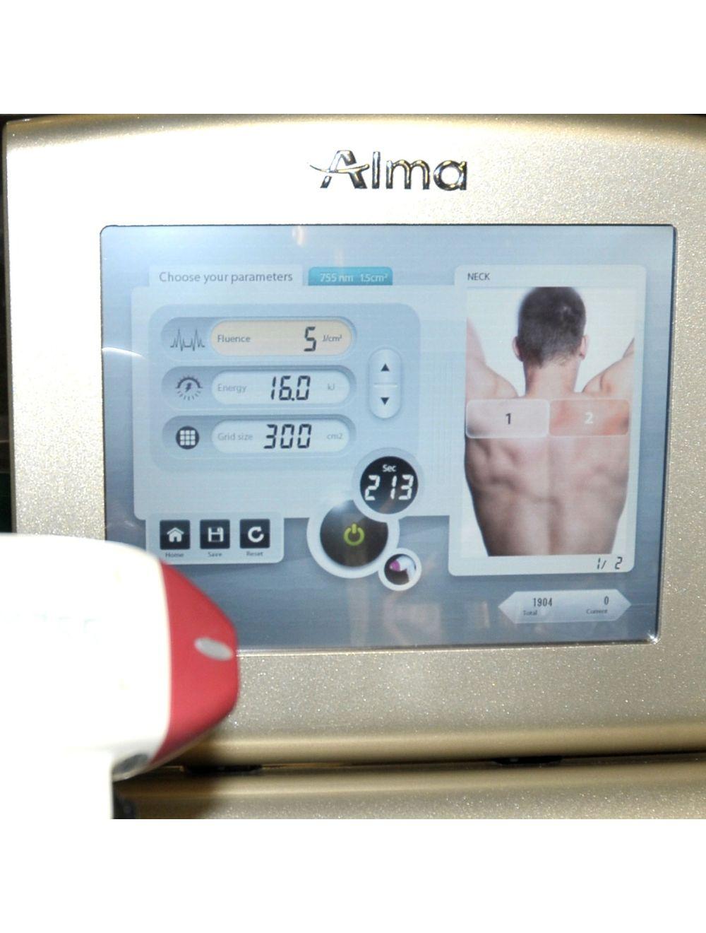 2016 Alma Diode Laser ALEX 755nm Platinum Soprano ICE Hair Removal Handpiece image 9