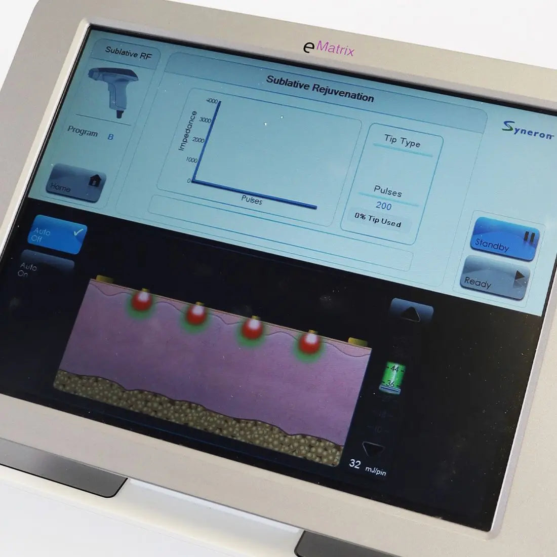 Syneron eMatrix Skin Rejuvenation TableTop Sublative RF System FG70442